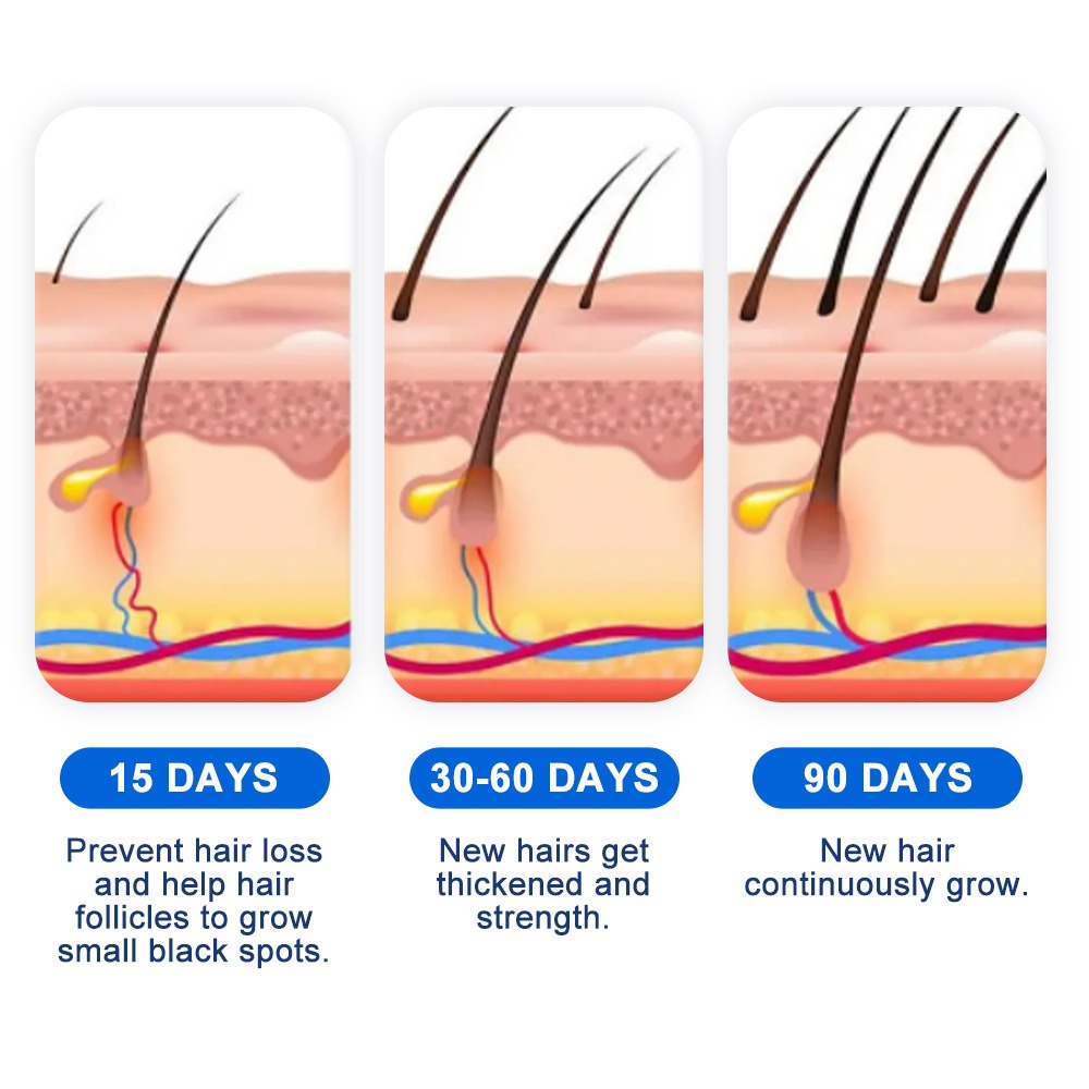 Alopecia Hair Growth Spray Sop - Hair Care For Hair Growth review and price