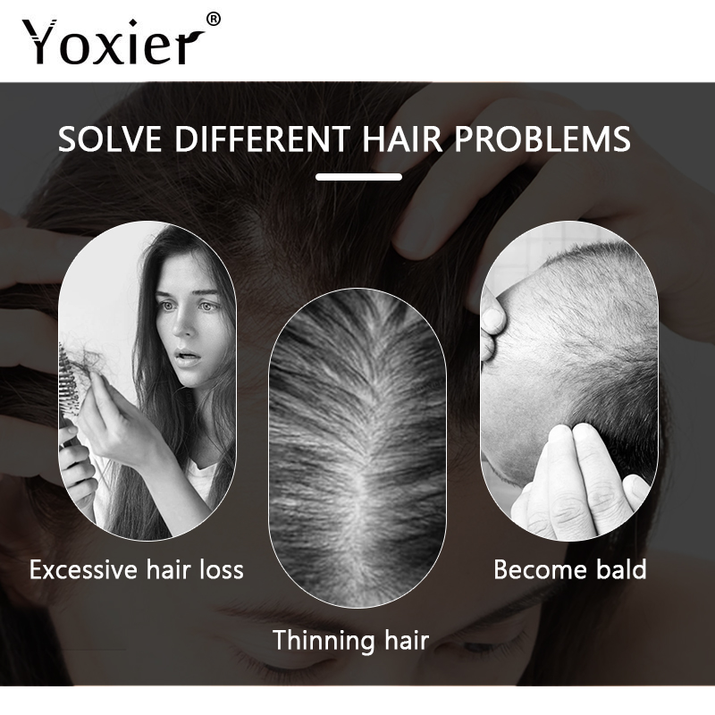 Intensive Growth Serum Prevent - Hair Care For Hair Growth review and price