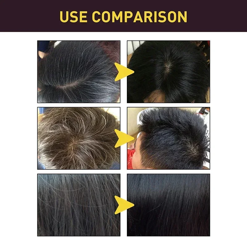 100ml Black Color Hair Dyeing  - Hair Care Loreal review and price