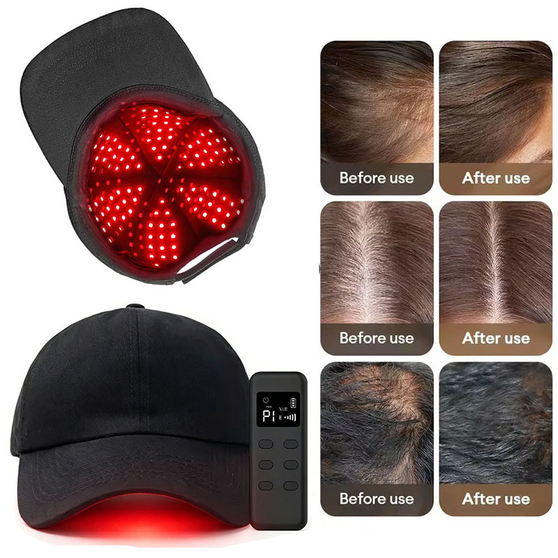 660nm 940nm Light 142 Groups / - Hair Care Wella review and price