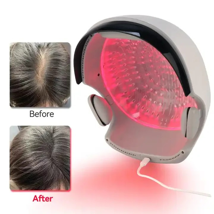 Red‑Light Hair Growth Helmet,  - Hair Care Lab review and price