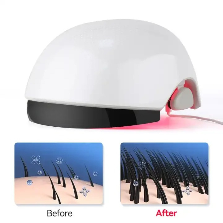 Red‑Light Hair Growth Helmet,  - Hair Care Lab review and price