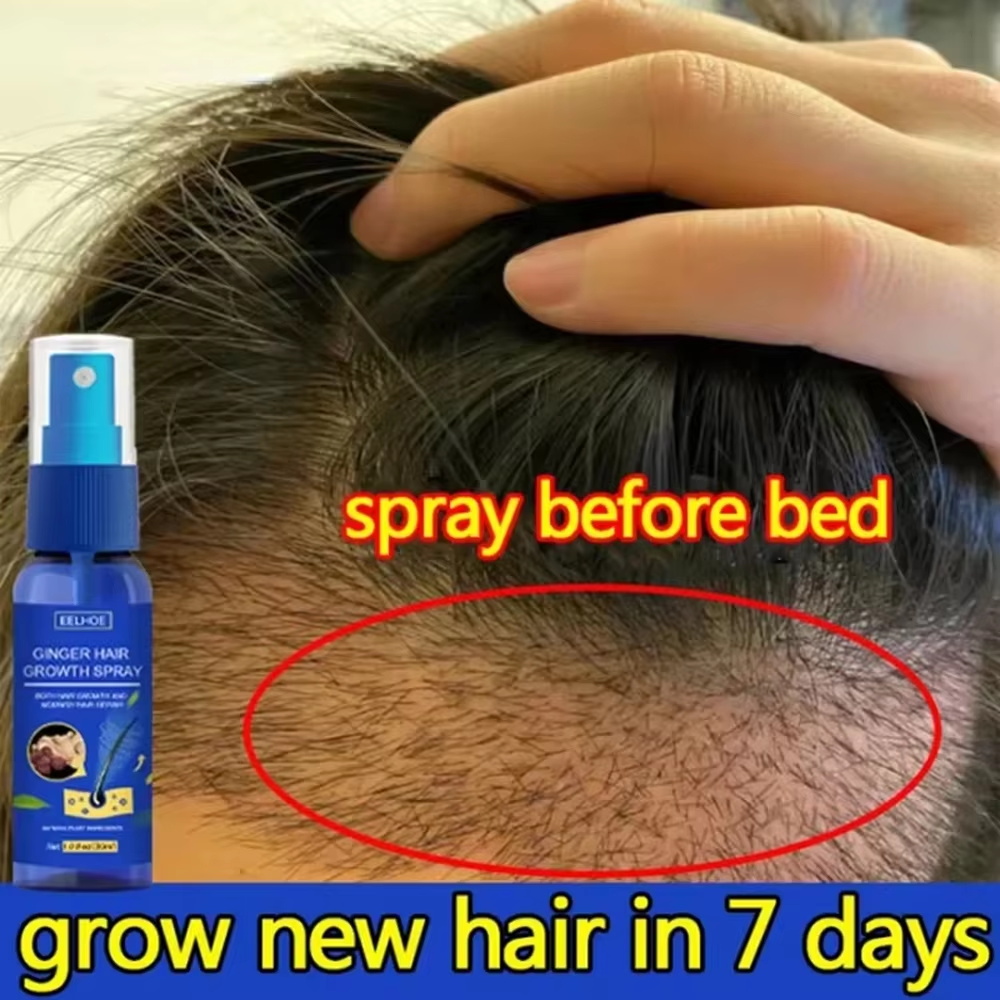 Fast Ginger Hair Growth Spray  - Hair Care For Men review and price