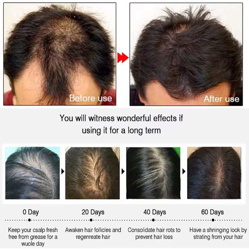 Fast Ginger Hair Growth Spray  - Hair Care For Men review and price