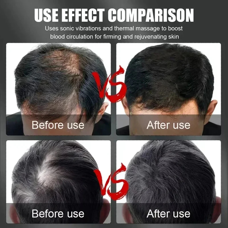 660nm 850nm Red Light Infrared - Hair Care For Hair Growth review and price